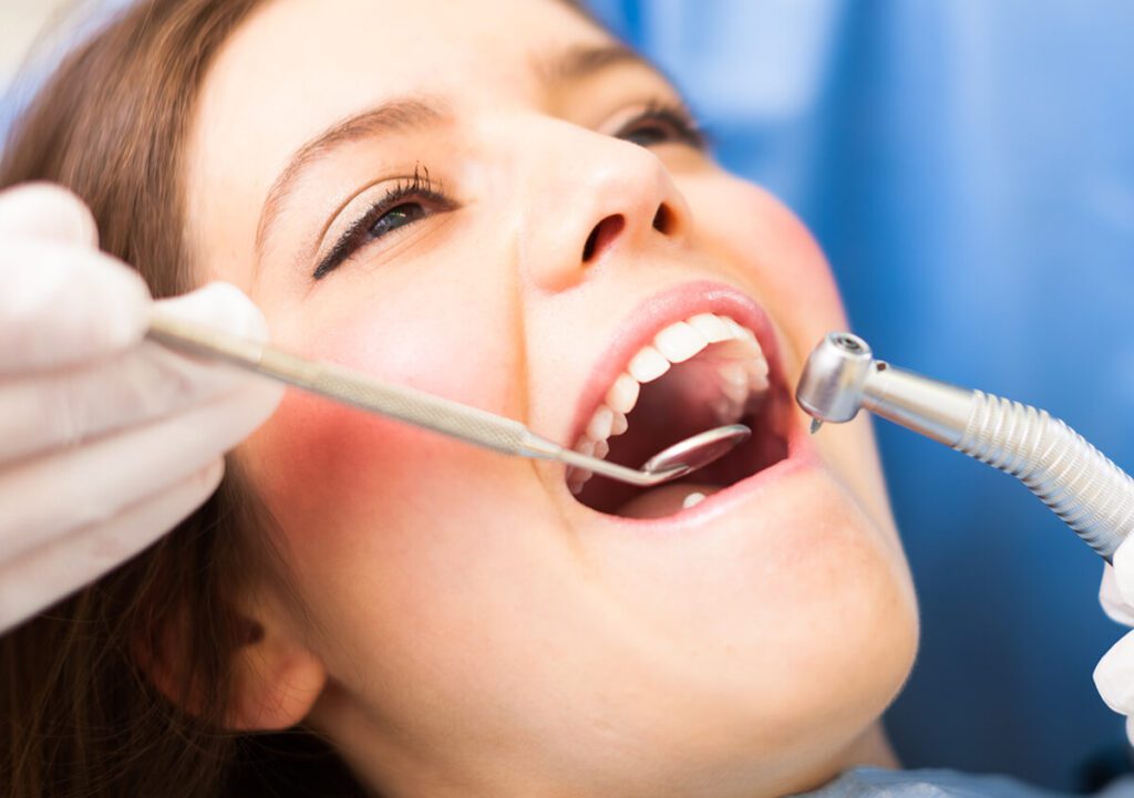 How Much is Teeth Bonding: A Complete Guide to Dental Bonding