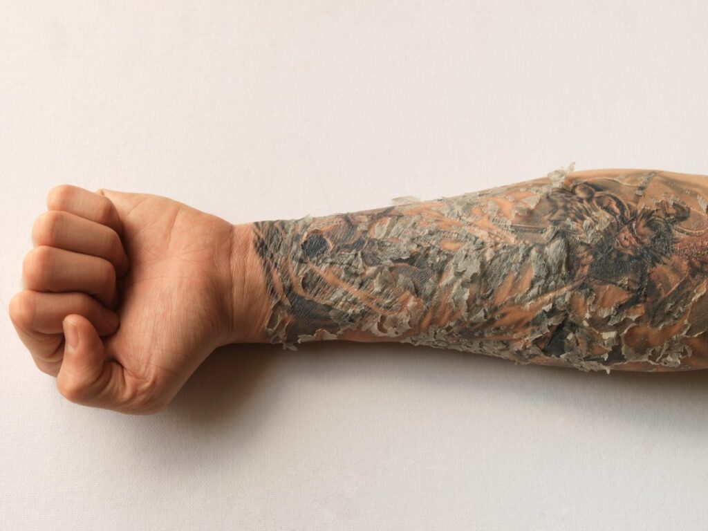 How to Deal With Scabbing on Your Tattoo