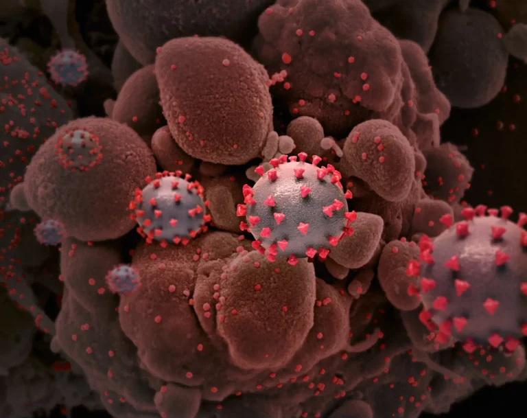 Dendritic Cell Therapy